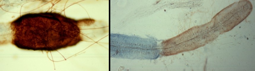 Mycorrhizal roots 2