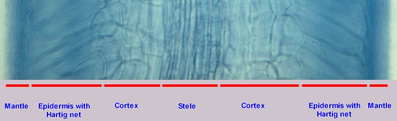 Mycorrhizal roots 1
