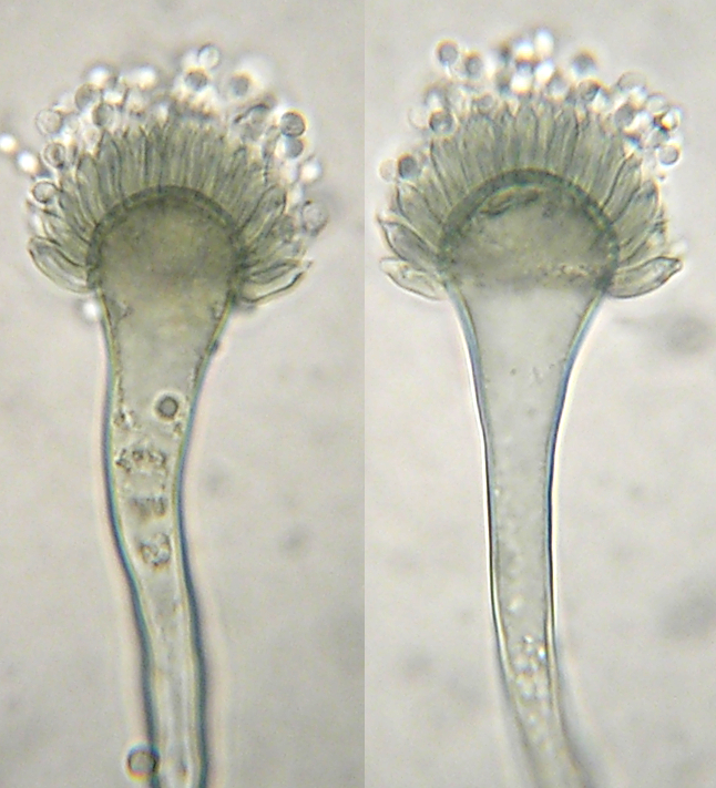 aspergillus conidiophores labeled