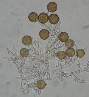 fungi microscope