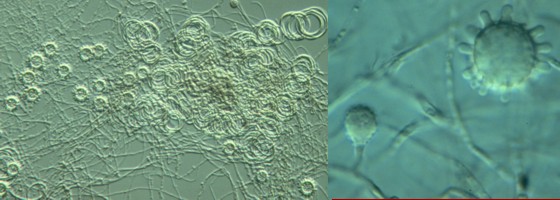 Picture of Ajellomyces capsulatus
