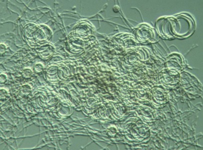 Ajellomyces capsulatus