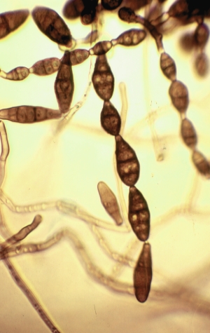 Alternaria