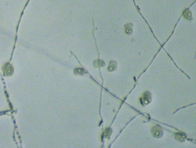 plasmodial slime molds under microscope