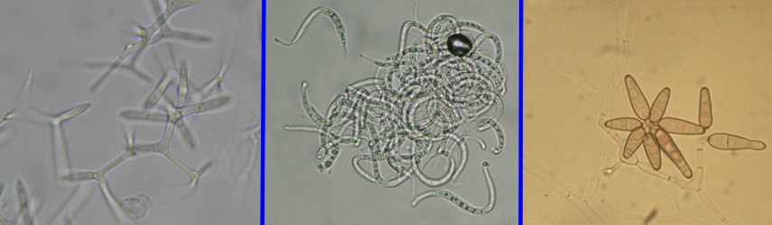 Marine hyphomycetes