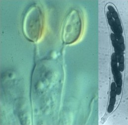 ascus and basidium