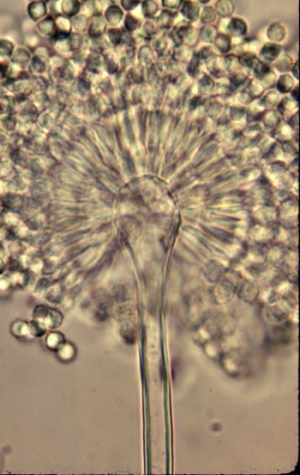 Aspergillus