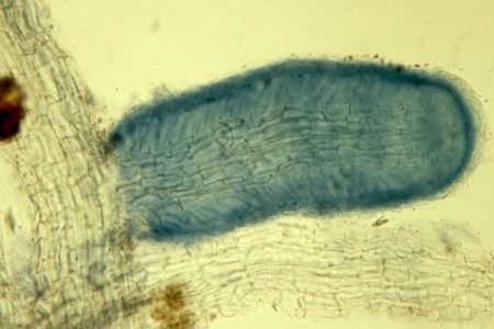 Birch mycorrhizae