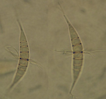Ascospores of Corollospora