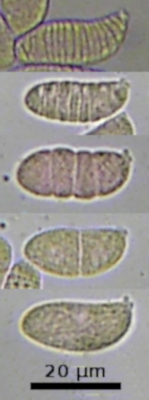 Dacrymyces basidiospore development