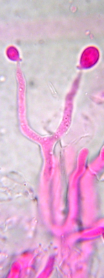 Dacrymyces basidium