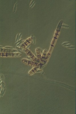 Dendryphiella salina