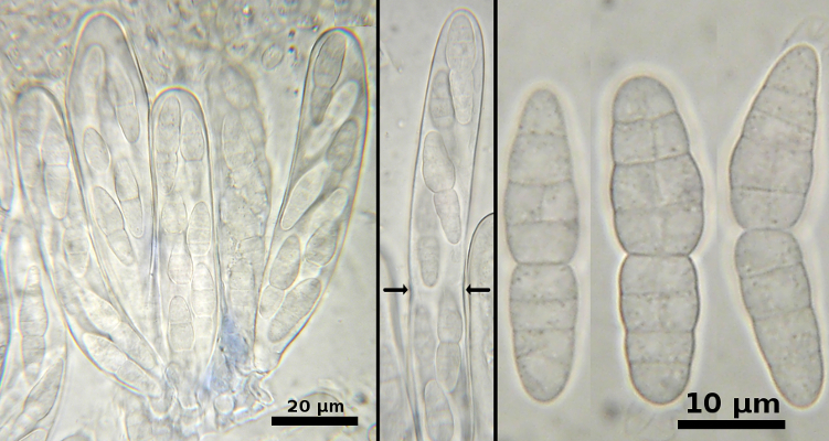 Dothiora pyrenophora-asci & ascospores