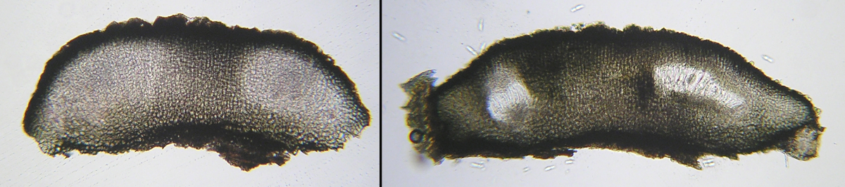Dothiora pyrenophora ascomatal development