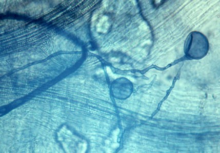 Hyphae with spores