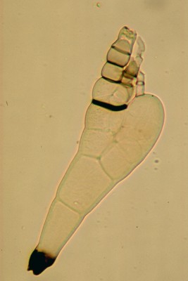 Laboulbenia philonthi - immature thallus