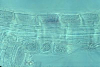 Mycorrhizae on Ledum