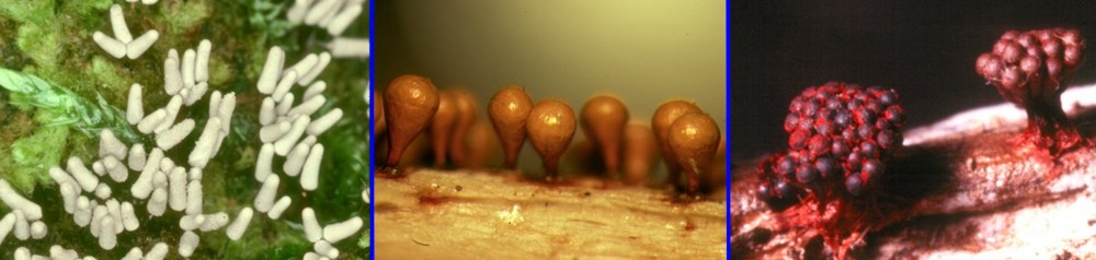 plasmodial slime molds under microscope