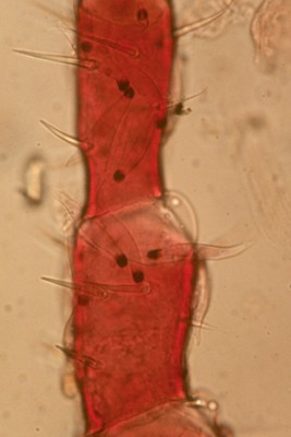 Pyxidiophora - ascospore on a mite 1