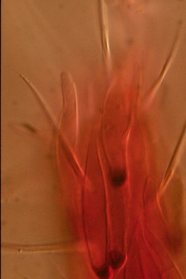 Pyxidiophora - ascospore on a mite 2