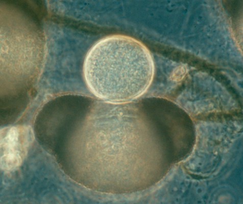 example of chytridiomycota