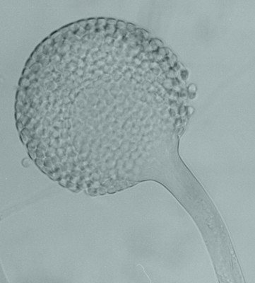 Rhizopus mature sporangium