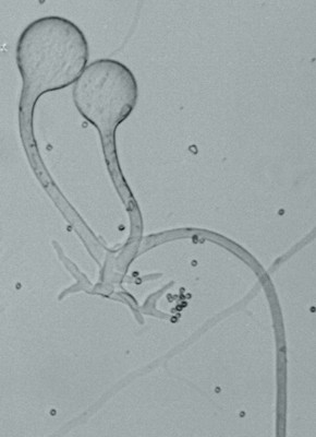 Rhizopus young sporangium