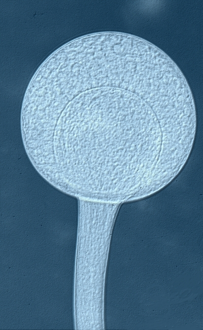 Rhizopus sporangium