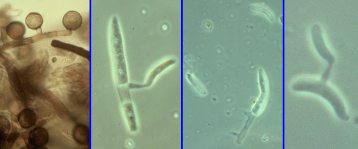 Septobasidium curtisii - Basidia