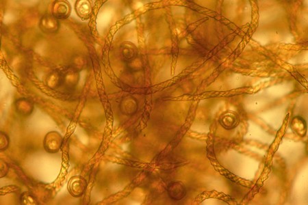 plasmodial slime molds under microscope