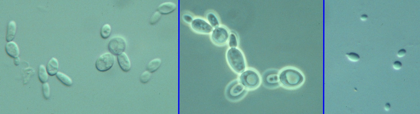 Fungi Yeasts