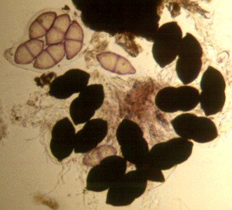 Zopfia rhizophila