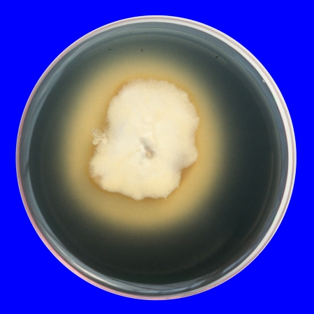Amanita citrina in Petri dish