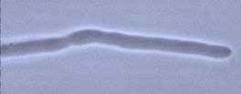 Hypha of Sordaria
