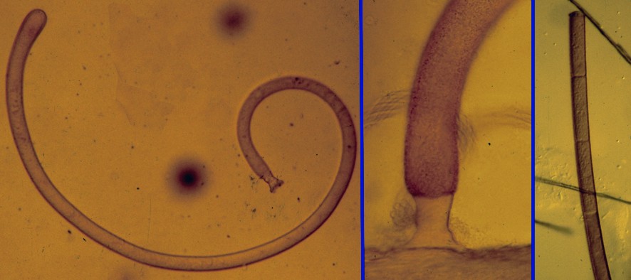 Enterobryus