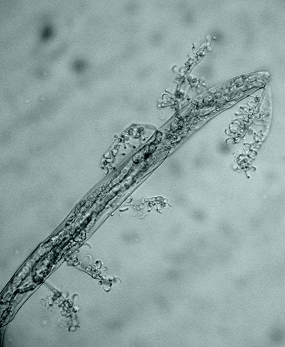 Nematode infected with Harposporium_anguillulae