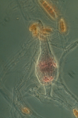 Parasites