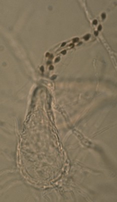 Pyxidiophora - perithecium with ascospores