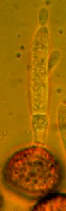 Ustilago maydis - basidium